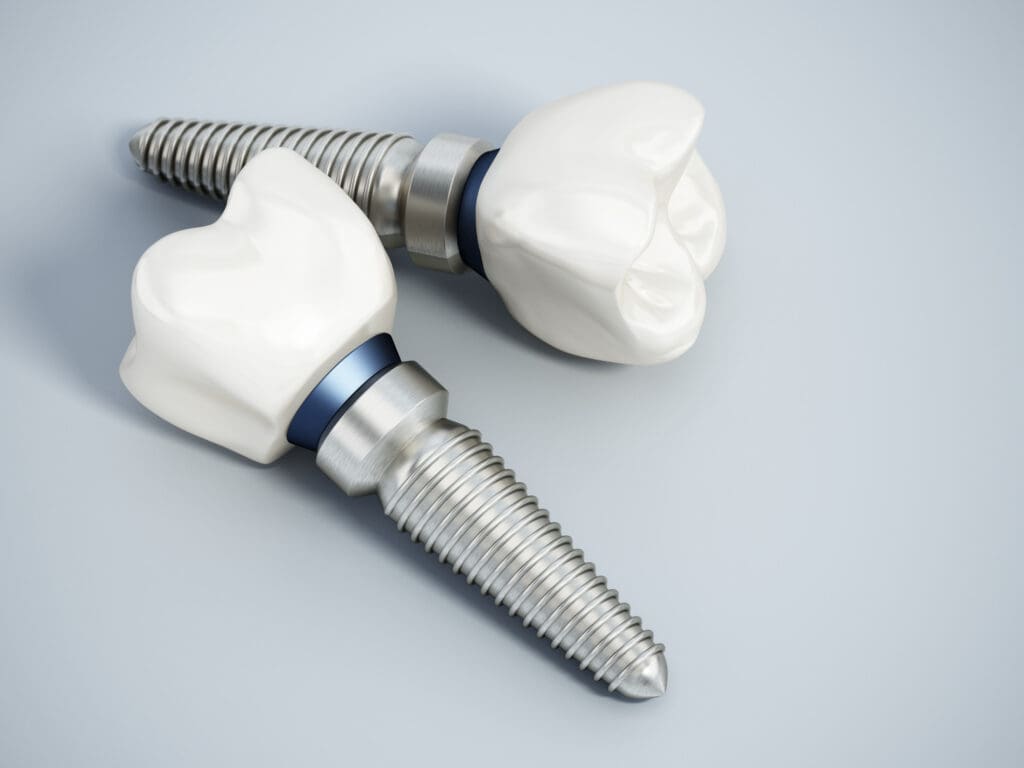Dental Implants Bryn Mawr PA